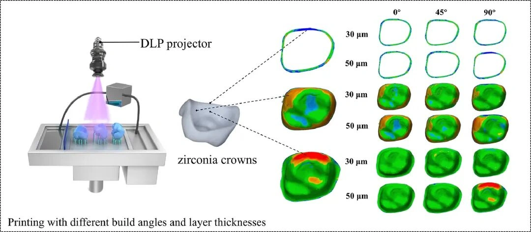Zirconia Single Crowns And The Expanding Horizon Of Ceramic 3D Printing In Dentistry